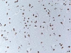 末端轉移酶 末端轉移酶