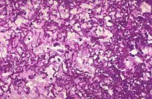 斯維鏈黴菌 斯維鏈黴菌