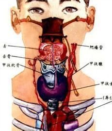 橋本甲狀腺炎 橋本甲狀腺炎