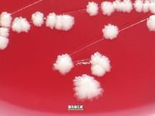 傑氏棒桿菌 傑氏棒桿菌