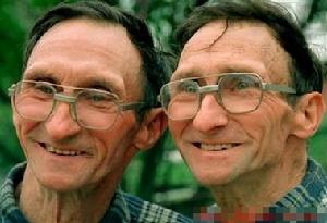 1999年5月6日賓夕法尼亞Phoenixville農場拍攝的瑞夫兄弟倆(左邊是約翰·瑞夫，右邊是威廉姆·瑞夫)，他們是世界上長的最像的一對雙胞胎。