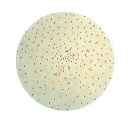 百日咳桿菌 百日咳桿菌