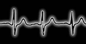 心搏密碼 心搏密碼