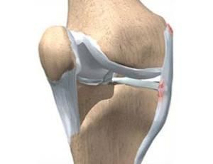 膝關節骨質增生