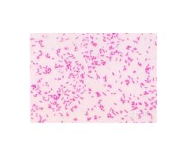 革蘭氏染色 革蘭氏染色