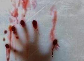 病態欣快感 病態欣快感