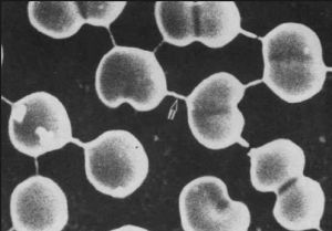 病毒性腦膜炎 病毒性腦膜炎