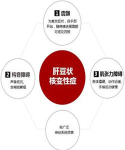 肝豆狀核變性疾病 肝豆狀核變性疾病