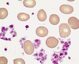 平均血小板體積 平均血小板體積