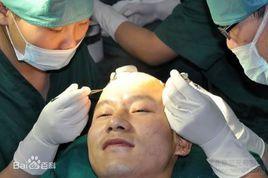 SCF無痕移植技術