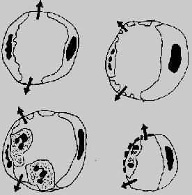 急性白細胞減少症 急性白細胞減少症