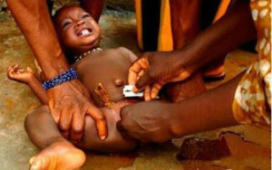 非洲割禮 非洲割禮