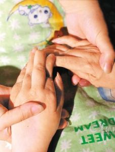 自體免疫性疾病