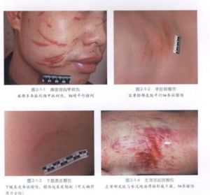 《法醫病理學圖鑑》內容