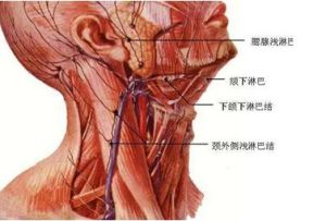 淋巴肉瘤 淋巴肉瘤