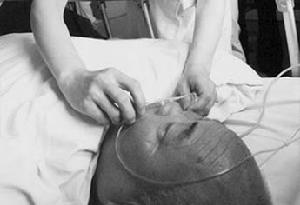 老年人急性心肌梗死