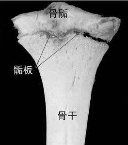 骺
