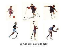 運動型大腿假肢 運動型大腿假肢