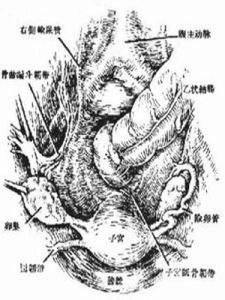 子宮積液 子宮積液