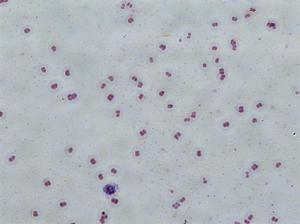 費氏微球菌 費氏微球菌