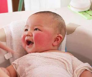 新生兒低血糖症