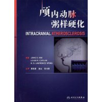 顱內動脈粥樣硬化 