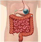 胃繞道手術示意圖