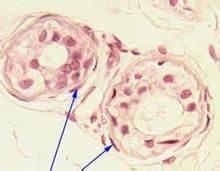 類上皮細胞 類上皮細胞