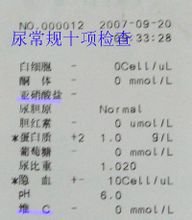 尿常規化驗單