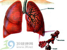 淋巴細胞間質性肺炎 淋巴細胞間質性肺炎