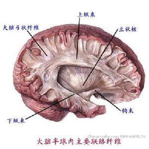 硬腦膜外血腫