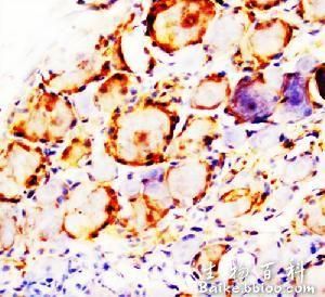 菌落雜交 菌落雜交