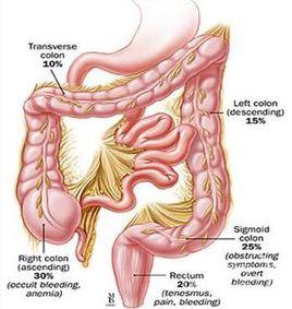 肛門異位 肛門異位
