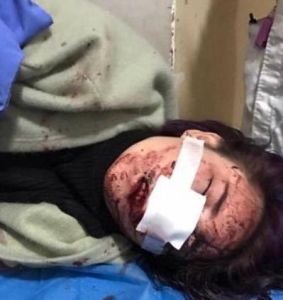 女孩被打躺在醫院