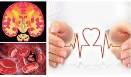 慢性腦缺血 慢性腦缺血