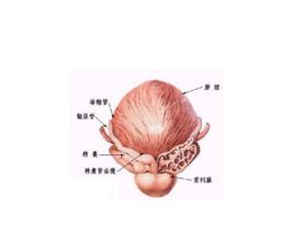 膀胱頸口硬化 膀胱頸口硬化