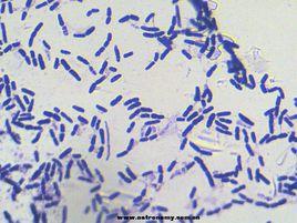 革蘭陽性菌 革蘭陽性菌