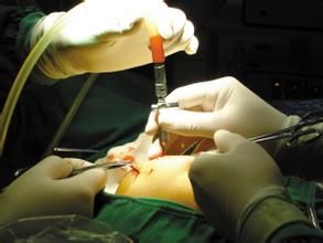 洗滌紅細胞 洗滌紅細胞