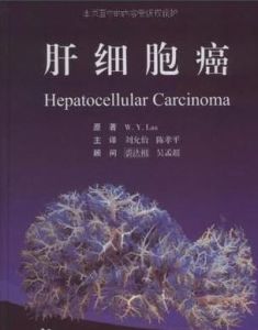 肝細胞癌 肝細胞癌
