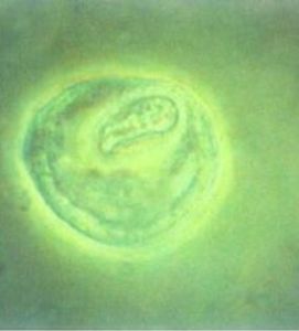 單核吞噬細胞系統