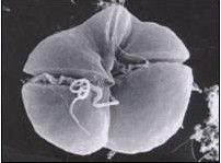 裸甲藻屬 裸甲藻屬