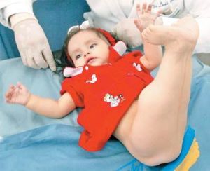 美人女綜合症患者