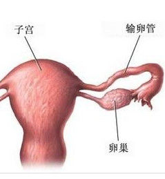 輸卵管梗阻