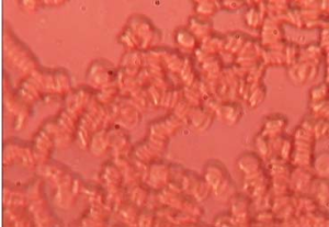 紅細胞滲透脆性試驗