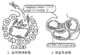 脂蛋白腎小球病