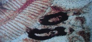 小鞘指環蟲 小鞘指環蟲