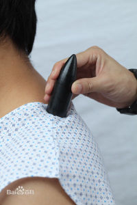 砭石錐肩部保健法
