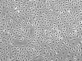 內皮細胞 內皮細胞