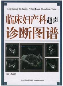 臨床婦產科超聲診斷圖譜 臨床婦產科超聲診斷圖譜