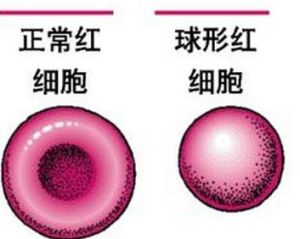 紅細胞平均血紅蛋白濃度 紅細胞平均血紅蛋白濃度